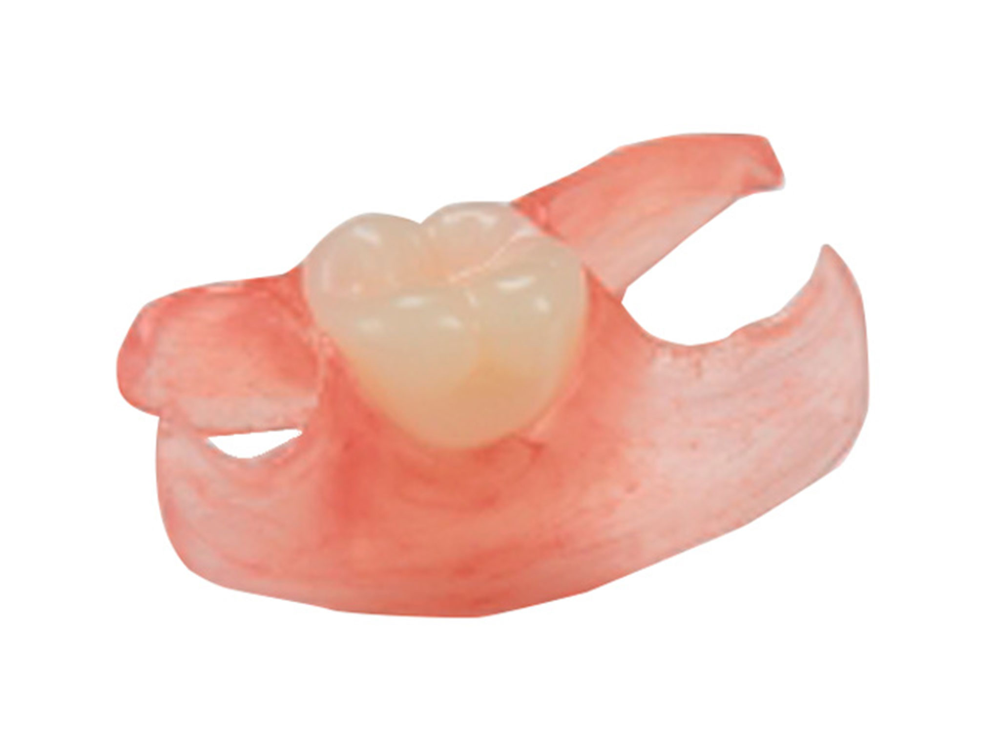 I have a tooth that is missing. What are my options for replacing my tooth?